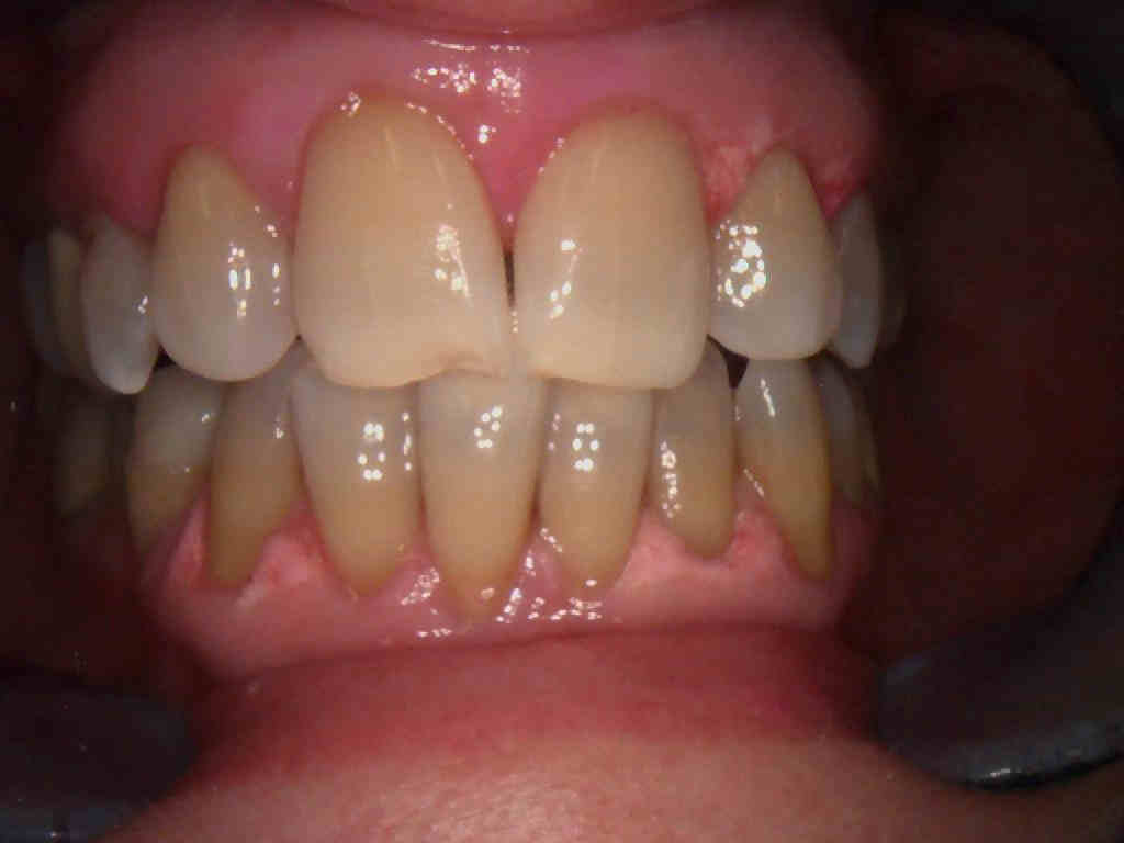 After Image