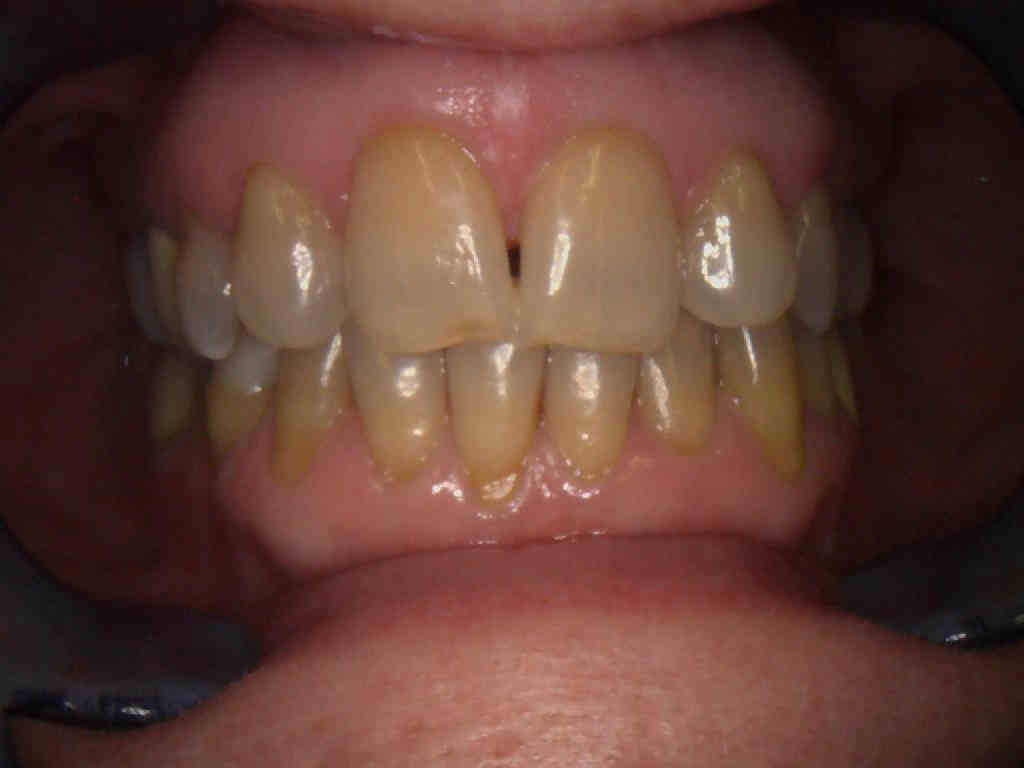 Before Image